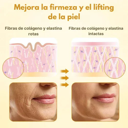 Crema lifting de veneno de abeja Ups