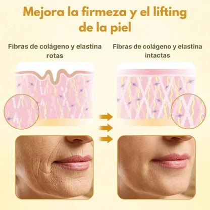 Crema lifting de veneno de abeja Ups